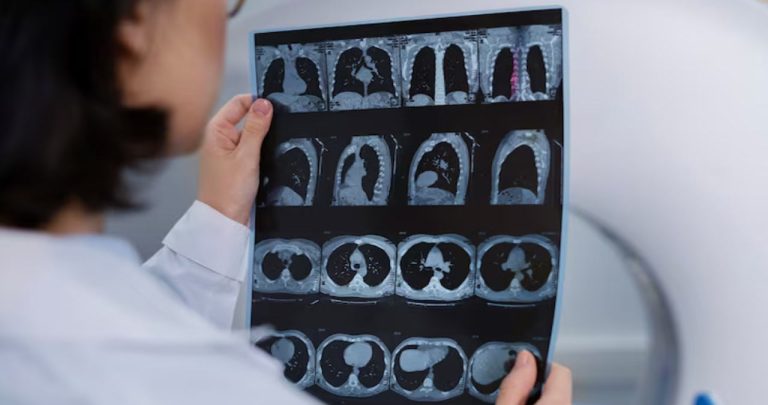 Pacient intrând într-un aparat RMN de ultimă generație într-o clinică din România pentru investigații decontate